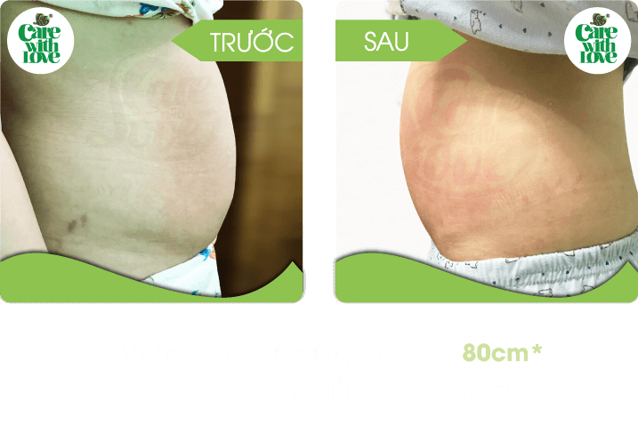 Chị Thảo, Săn chắc sau sinh 15 buổi