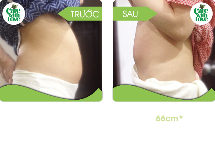 Chị Linh, Toàn diện sau sinh 15 buổi