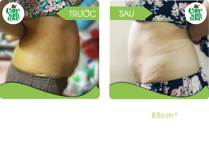 Chị Trâm, Toàn diện sau sinh 20 buổi