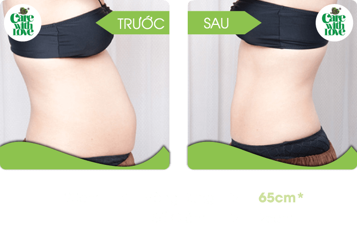 Chị Vi, Toàn diện sau sinh 20 buổi